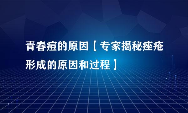 青春痘的原因【专家揭秘痤疮形成的原因和过程】