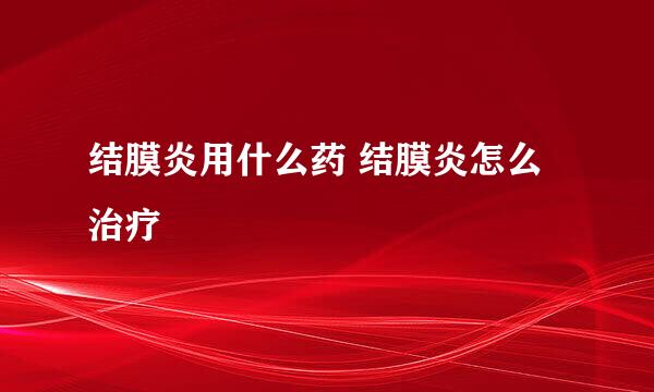 结膜炎用什么药 结膜炎怎么治疗