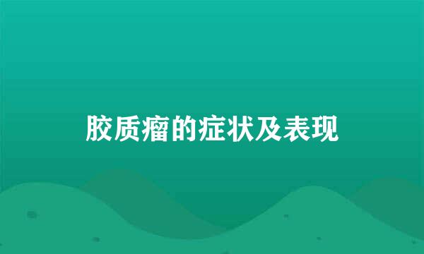 胶质瘤的症状及表现