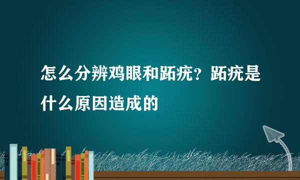 怎么分辨鸡眼和跖疣？跖疣是什么原因造成的