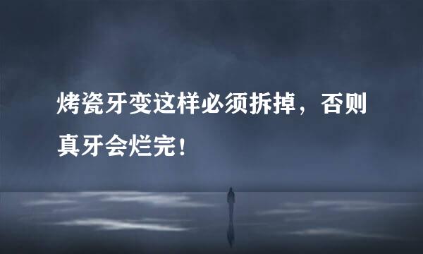 烤瓷牙变这样必须拆掉，否则真牙会烂完！