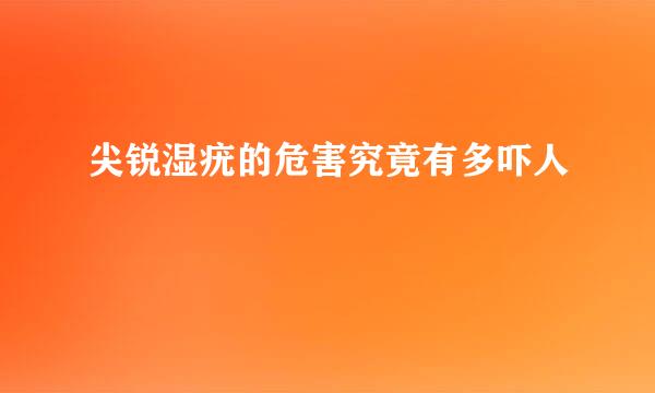 尖锐湿疣的危害究竟有多吓人