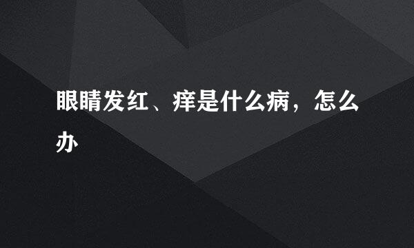 眼睛发红、痒是什么病，怎么办
