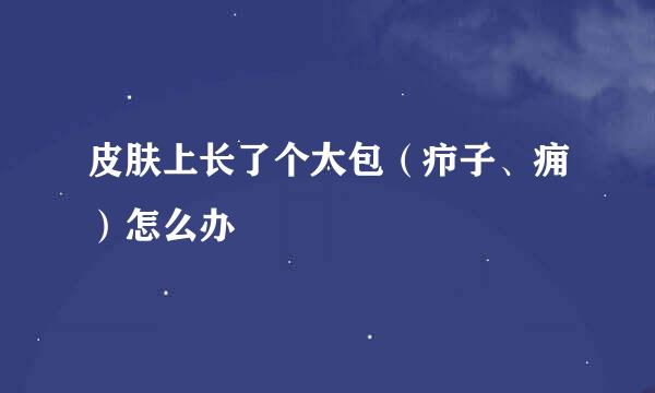 皮肤上长了个大包（疖子、痈）怎么办
