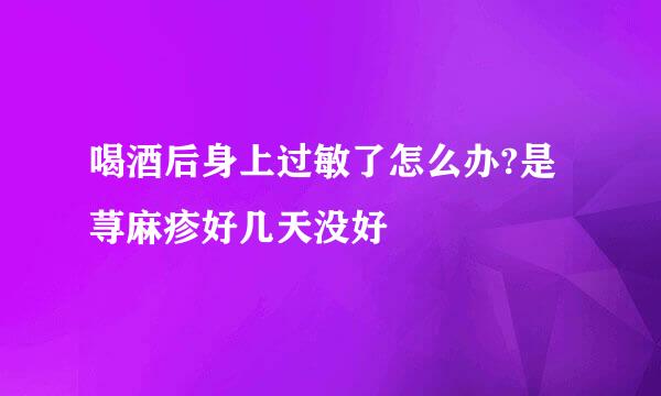 喝酒后身上过敏了怎么办?是荨麻疹好几天没好