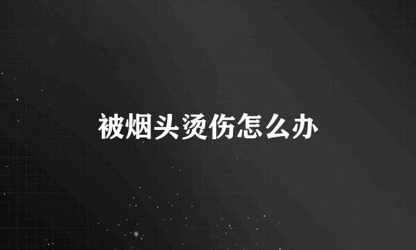 被烟头烫伤怎么办