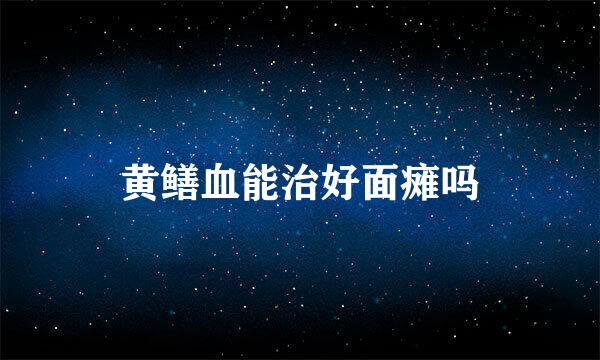黄鳝血能治好面瘫吗