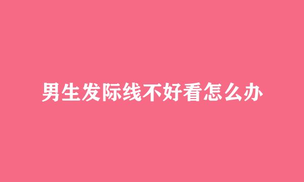 男生发际线不好看怎么办