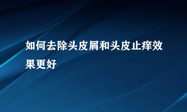 如何去除头皮屑和头皮止痒效果更好