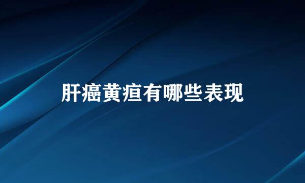 肝癌黄疸有哪些表现