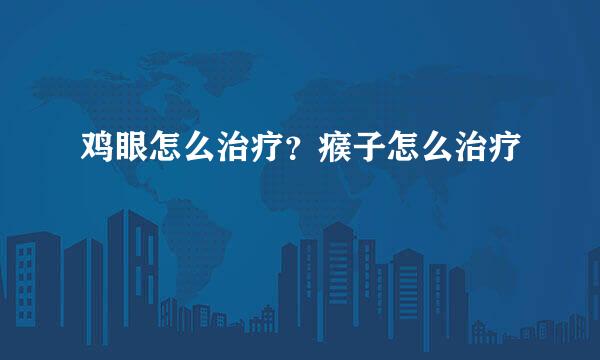 鸡眼怎么治疗?瘊子怎么治疗